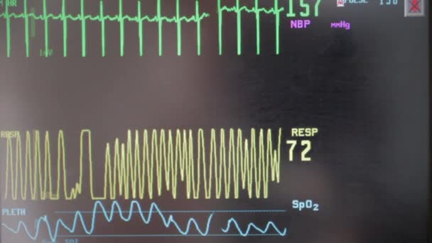 Hospital Heart Monitor Monitor Baby Pregnant Mother Currently Labor — Vídeo de stock