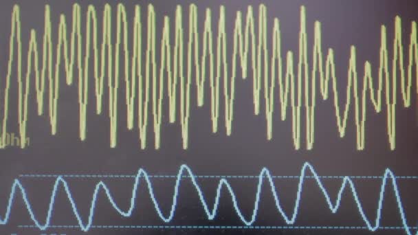 Hospital Heart Monitor Monitor Baby Pregnant Mother Currently Labor — Wideo stockowe