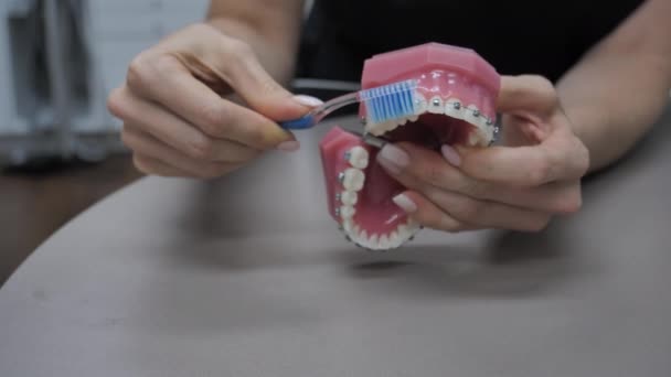 Woman Brushes Teeth Braces — Stok video