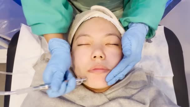 Ασιατική Κορίτσι Πάρει Προσώπου Θεραπεία Αναρρόφηση Peel Για Αφαιρέσετε Νεκρό — Αρχείο Βίντεο
