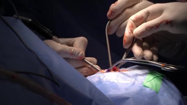 Neurosurgery Neurological Surgery Known Common Parlance Brain Surgery Medical Specialty — Stock videók