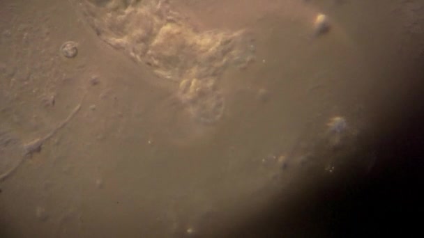 Microscopic Rotifers Feed Move — Stock video