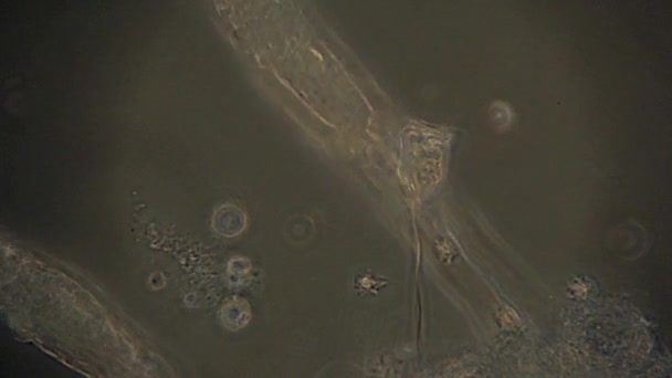 Vorticella Microscópica Protista Forma Tulipán Alimenta Con Cilios Alrededor Cavidad — Vídeos de Stock
