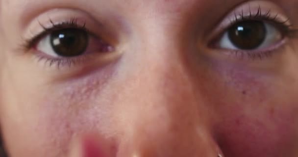 Extreme Close Young Woman Purple Hair Examining Her Bloodshot Eye — Stok Video