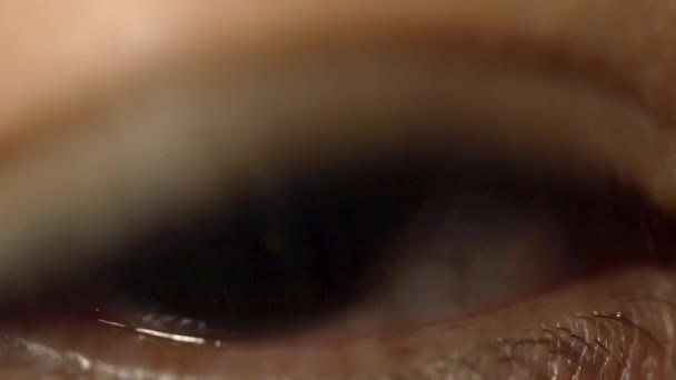 Aanpak Van Een Oog Met Zijn Verwijde Pupil — Stockvideo