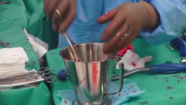 Surgical Nurse Also Referred Theatre Nurse Scrub Nurse Specializes Preoperative — Wideo stockowe