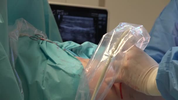 Endovenous Laser Ablation Evla Commonly Used Very Effective Minimally Invasive — Video