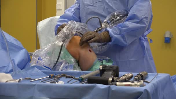 Anterior Cruciate Ligament Reconstruction Acl Reconstruction Surgical Tissue Graft Replacement — Αρχείο Βίντεο