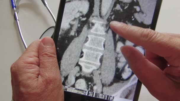 Physician Inspect Scan — Stockvideo