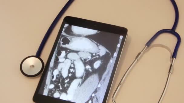 Scan Tablet Diagnosis — Vídeo de Stock