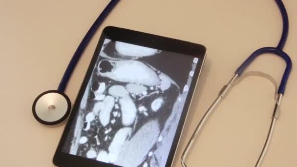 Scan Tablet Diagnosis — Stock videók