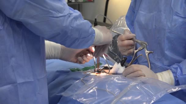 Asgari Invaziv Ameliyatlar Gerekli Kesiklerin Boyutunu Sınırlayan Cerrahi Teknikleri Kapsar — Stok video