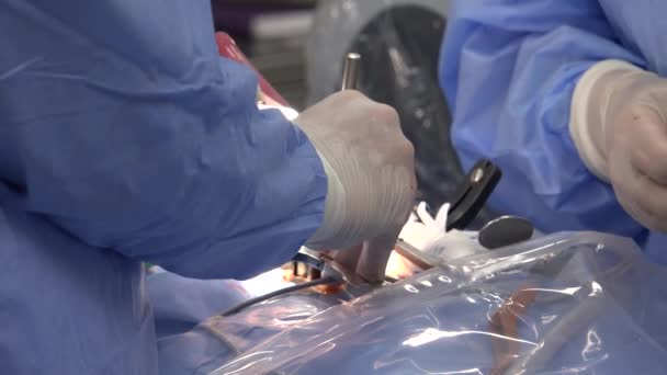 微创手术包括各种手术技术 以限制所需切口的大小 从而减少创面愈合时间 相关的疼痛和感染风险 — 图库视频影像