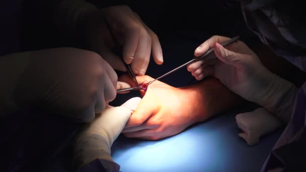 Act Performing Surgery May Called Surgical Procedure Operation Simply Surgery — Αρχείο Βίντεο