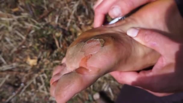 Cleaning Dirty Blistered Callused Feet Festival — Video Stock
