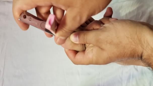 Pie Corte Uñas Con Las Uñas Dañadas Debido Los Hongos — Vídeo de stock