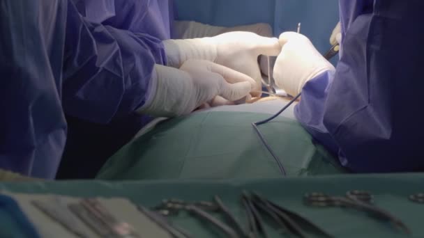 Cirugía Una Sala Operaciones Hospital — Vídeo de stock