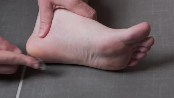 Muž Který Odstraňuje Kukuřici Kalusových Jeho Nohou Používá Břitvu Mužský — Stock video