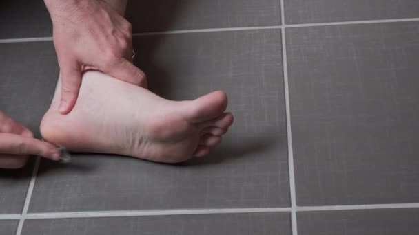 Mann Entfernt Mais Schwiele Von Seinen Füßen Mit Einer Rasierklinge — Stockvideo