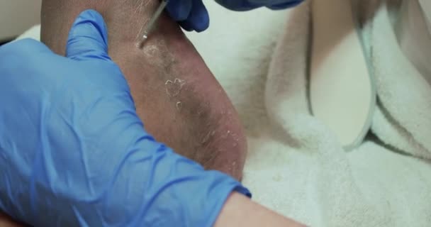 左足の内側に死んだ皮膚をこすりつける — ストック動画