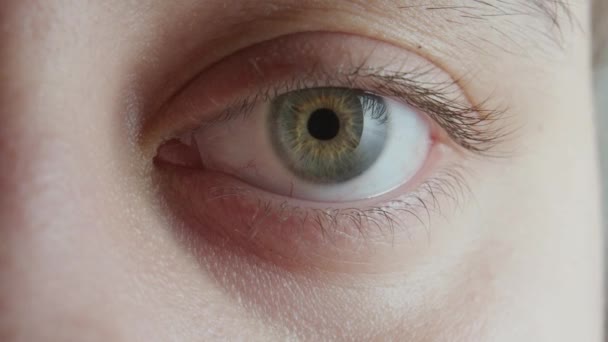 Close Van Het Oog Pupilverwijding Opening Van Het Oog Vrouw — Stockvideo