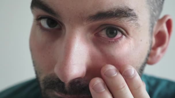Muž Červenýma Očima Hledící Kamery Detailní Záběr — Stock video