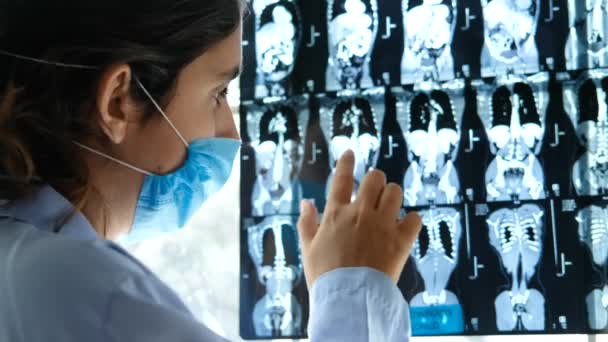 Perto Uma Médica Discutir Uma Ressonância Magnética Análise Tomografia Abdômen — Vídeo de Stock