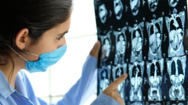 Zbliżenie Lekarza Badającego Tomografię Abodemową Rezonans Magnetyczny Choroba Płuc — Wideo stockowe