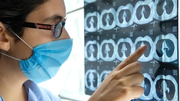 Mujer Médico Examinando Tomografía Tórax Enfermedades Pulmonares Rayos Scan — Vídeo de stock