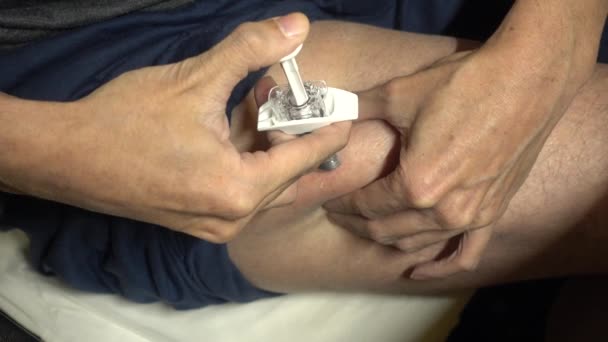 Subcutane Injectie Injectieplaats Van Bovenbeen Zelfinjectietechniek — Stockvideo