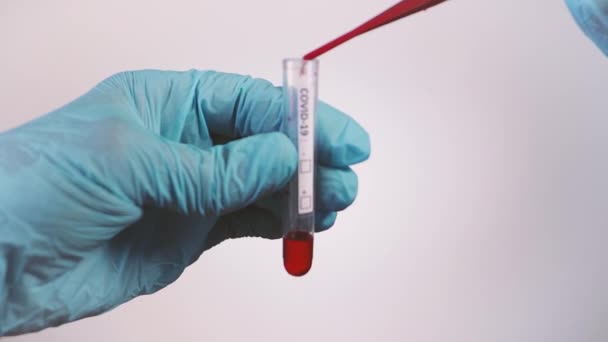 Ręce Rękawiczki Używają Pipety Wrzucania Krwi Fiolki Celu Wykonania Testów — Wideo stockowe