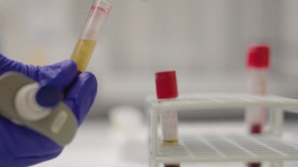 Εργάτης Εργαστηρίου Δείγμα Αίματος Εξάγει Στρώμα Ορού Πλάσματος Από Δοκιμαστικό — Αρχείο Βίντεο