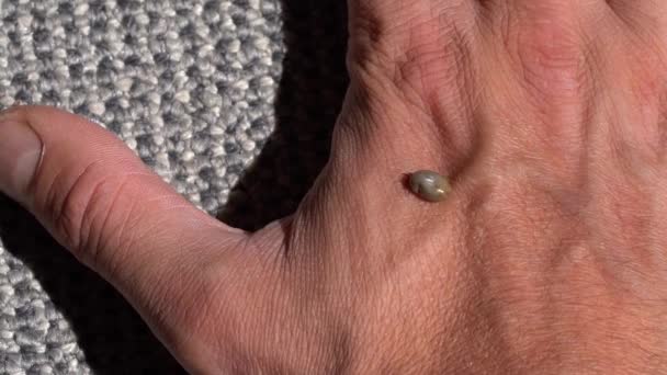 Large Fully Engorged Tick Walking Human Hand Macro Side Shot — Stock Video