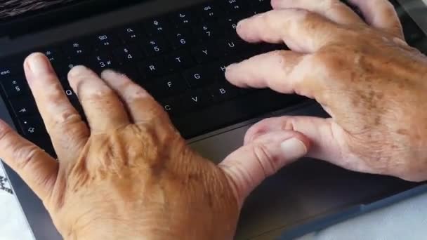 Vitiligo Mâinile Unei Femei Care Lucrează Calculul — Videoclip de stoc