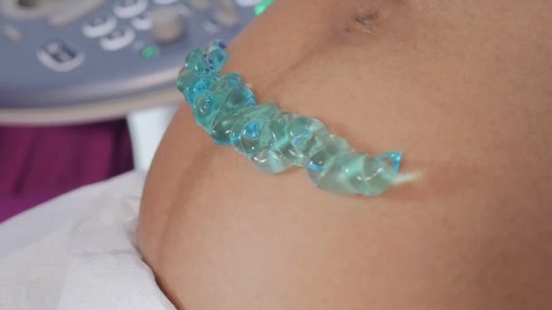 超音波妊娠トランスデューサ青いゲル妊娠腹超音波スキャナー閉じる導電性ゲル — ストック動画