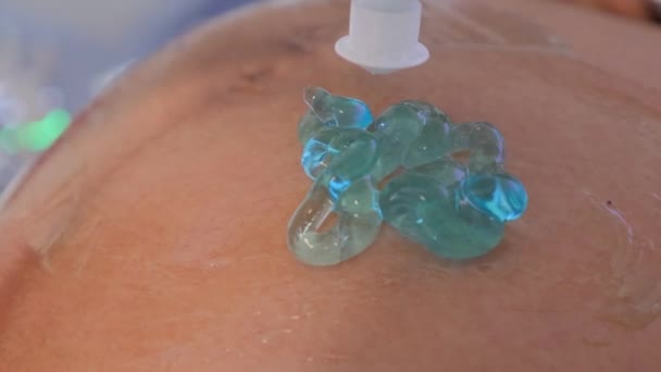 超声怀孕传感器蓝色凝胶妊娠期超声扫描仪特写导电凝胶5D超声 — 图库视频影像