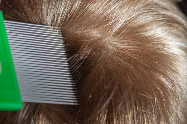 Comb out lice from the hair with a special comb with frequent teeth.