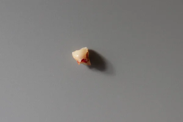 Dente Bebé Desaparecido Num Fundo Cinzento Espaço Cópia — Fotografia de Stock