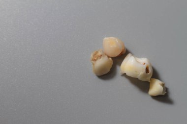 Gri bir arka planda bebek bakımı izleri olan bir çocuk dişini kaybetti..