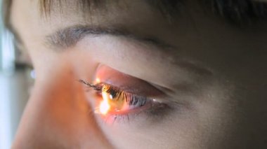 Doktor optometrist göz doktoruna bir özel araç, yakın çekim 4 kullanarak hastaya retina inceliyor