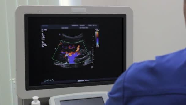 El médico muestra en el monitor Ultrasonografía examen de los vasos de color del árbol y la arteria renal — Vídeos de Stock