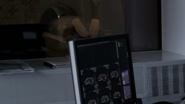 Computertomographie des Gehirns auf einem Computermonitor in Echtzeit — Stockvideo