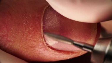 Macro view of removing cuticle and polishing finger nail by electric drill filmed from above