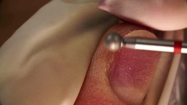 Makro materiał filmowy z automatycznego manicure wiertła elektrycznego, gdzie mistrz poleruje paznokcie i skórę — Wideo stockowe