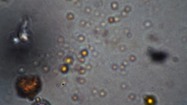 Клетка аллергической пыльцы стопы также выглядит как коронавирус под микроскопом. — стоковое видео