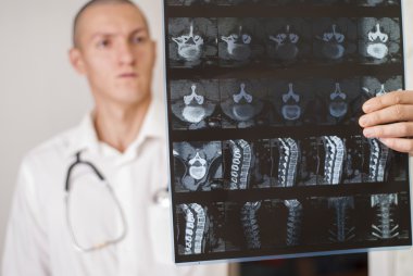 Bilgisayarlı tomografi sonuçları
