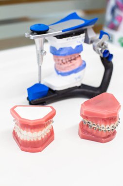 Diş aygıtı yapmak için araç