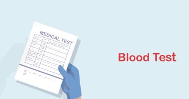 Kan testi iniş sayfası. Doktorların, tıbbi laboratuvar çalışanlarının çalışma alanlarında kan örnekleri, test tüpleri ve analiz sonuçlarına sahip afişler. Düz grafik çizgi film