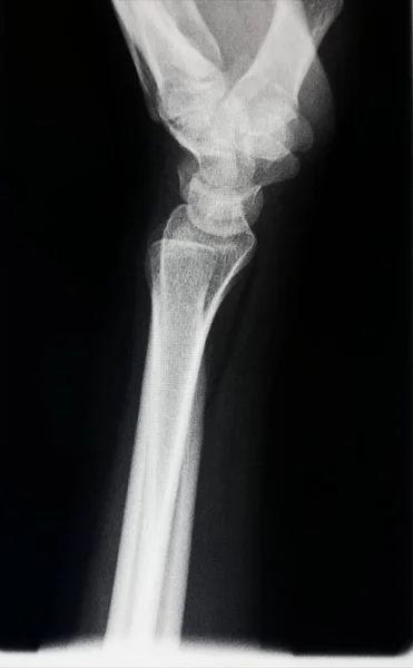 Imaging Medico Radiografia Ossea Umana — Foto Stock