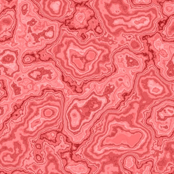 pembe malakit nedeni